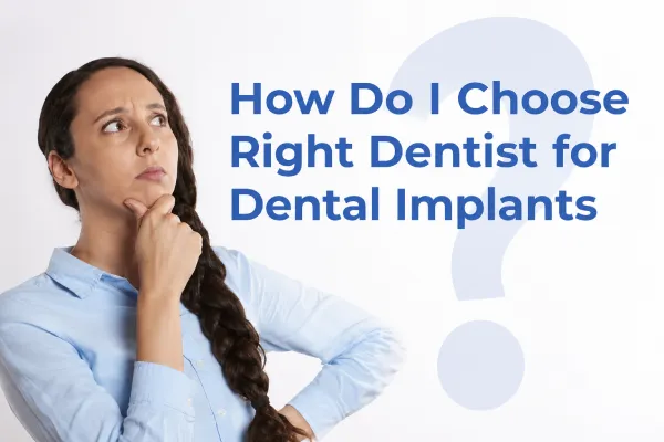 How Do I Choose the Right Dentist for Dental Implants?