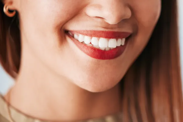 Can We Get Teeth Whitening If We Have Dentures? | Stuart