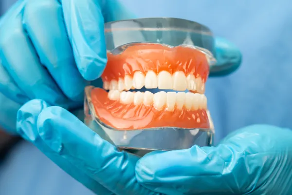 Dental professional holding a denture model for dentures in Stuart consultation