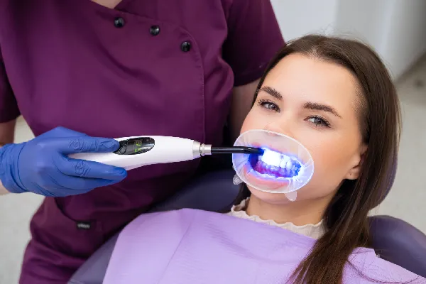 Foods to Avoid After Teeth Whitening in Stuart